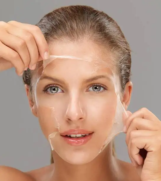 Chemical peel being applied to a patient’s face