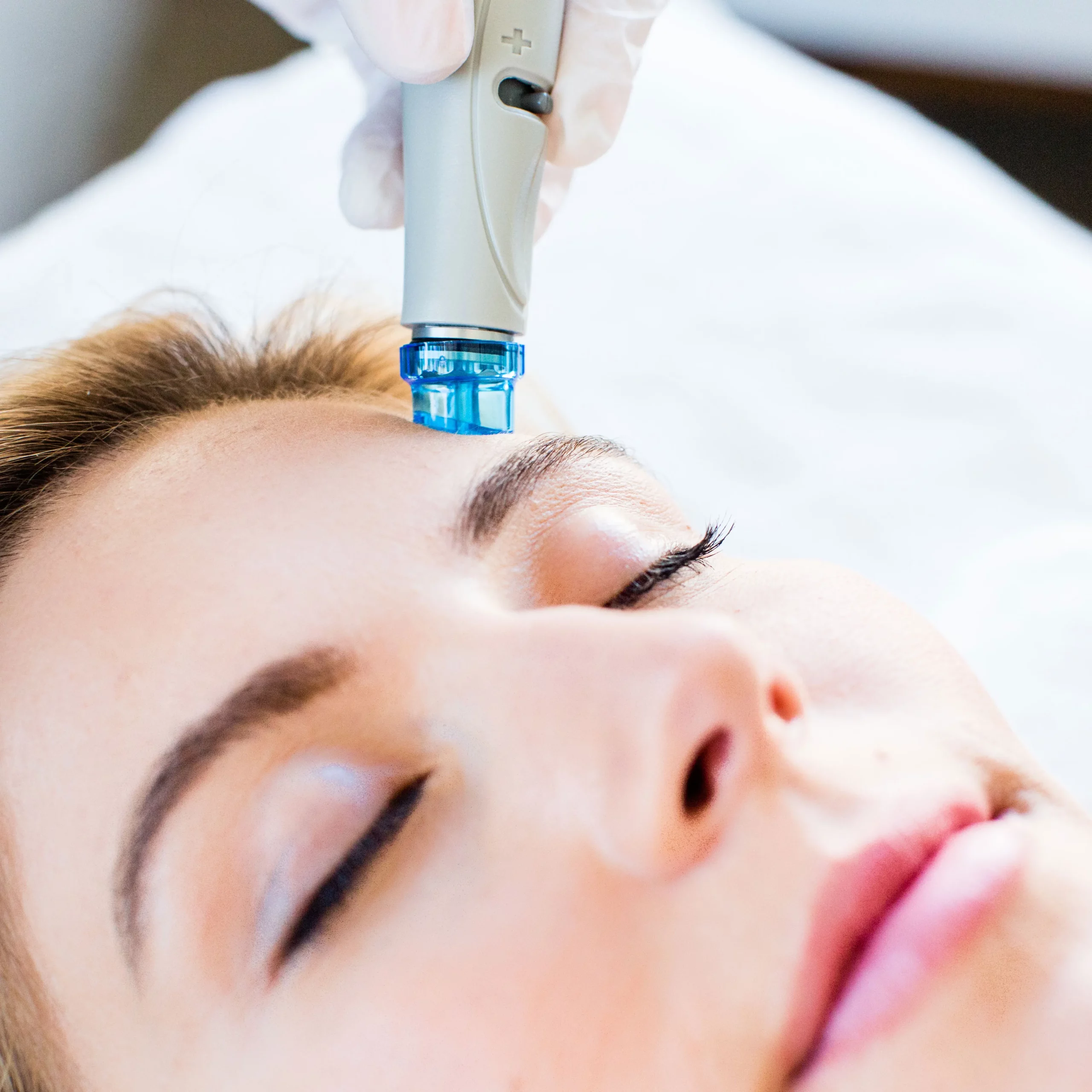 Hydra facial machine treating a patient’s skin