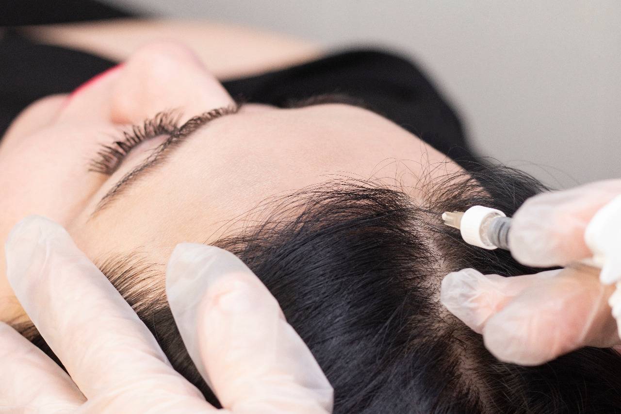Platelet rich plasma (PRP) therapy preparation
